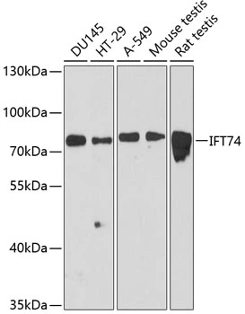 WB analysis of various sample lysates using GTX64834 CMG1 antibody. Dilution : 1:3000 Loading : 25microg per lane WB analysis of various sample lysates using GTX64834 CMG1 antibody. Dilution : 1:3000 Loading : 25microg per lane