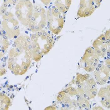 IHC-P analysis of human stomach tissue using GTX64837 ATP2C1 antibody. Dilution : 1:100