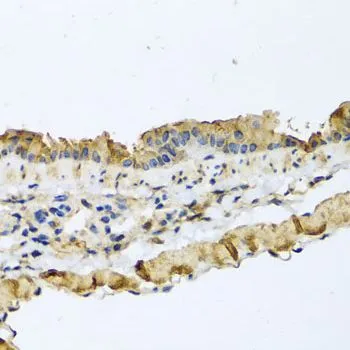 IHC-P analysis of mouse lung tissue using GTX64837 ATP2C1 antibody. Dilution : 1:100