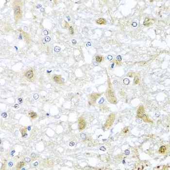 IHC-P analysis of rat brain tissue using GTX64837 ATP2C1 antibody. Dilution : 1:100
