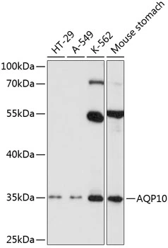 WB analysis of various sample lysates using GTX64838 Aquaporin 10 antibody. Dilution : 1:1000 Loading : 25microg per lane WB analysis of various sample lysates using GTX64838 Aquaporin 10 antibody. Dilution : 1:1000 Loading : 25microg per lane