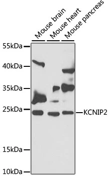 WB analysis of various sample lysates using GTX64846 KChIP2 antibody. Dilution : 1:1000 Loading : 25microg per lane WB analysis of various sample lysates using GTX64846 KChIP2 antibody. Dilution : 1:1000 Loading : 25microg per lane