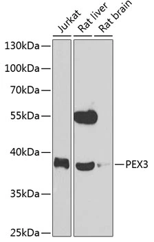 WB analysis of various sample lysates using GTX64847 PEX3 antibody. The signal was developed with ECL plus-Enhanced. Dilution : 1:1000 Loading : 25microg per lane WB analysis of various sample lysates using GTX64847 PEX3 antibody. The signal was developed with ECL plus-Enhanced. Dilution : 1:1000 Loading : 25microg per lane