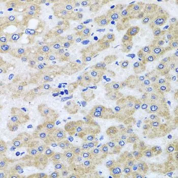IHC-P analysis of human liver damage tissue using GTX64847 PEX3 antibody. Dilution : 1:100