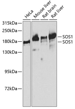 WB analysis of various sample lysates using GTX64852 SOS1 antibody. Dilution : 1:1000 Loading : 25microg per lane