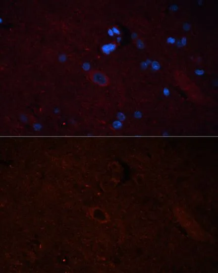 IHC-P analysis of rat brain tissue using GTX64852 SOS1 antibody. Blue : DAPI Dilution : 1:100