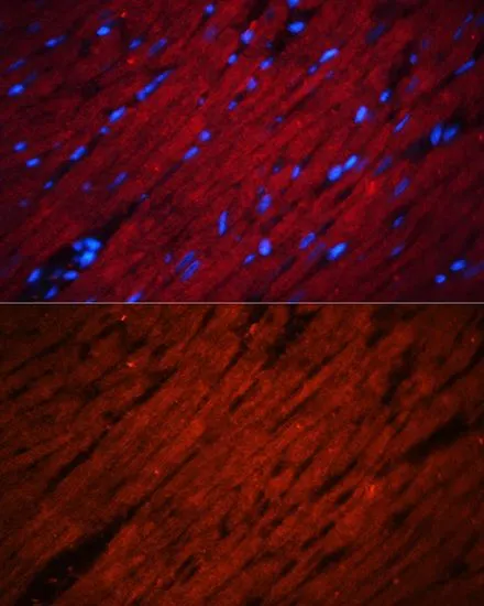 IHC-P analysis of rat heart tissue using GTX64852 SOS1 antibody. Blue : DAPI Dilution : 1:100