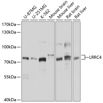WB analysis of various sample lysates using GTX64855 LRRC4 antibody. Dilution : 1:1000 Loading : 25microg per lane WB analysis of various sample lysates using GTX64855 LRRC4 antibody. Dilution : 1:1000 Loading : 25microg per lane