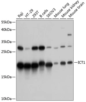 WB analysis of various sample lysates using GTX64859 ICT1 antibody. Dilution : 1:1000 Loading : 25microg per lane WB analysis of various sample lysates using GTX64859 ICT1 antibody. Dilution : 1:1000 Loading : 25microg per lane