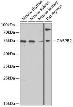 WB analysis of various sample lysates using GTX64862 GABPB2 antibody. Dilution : 1:1000 Loading : 25microg per lane WB analysis of various sample lysates using GTX64862 GABPB2 antibody. Dilution : 1:1000 Loading : 25microg per lane