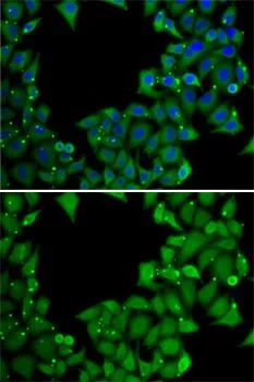 ICC/IF analysis of MCF7 cells using GTX64868 Rhotekin antibody. Blue : DAPI