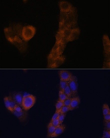 WB analysis of various samples using GTX64876 RPL23A antibody. Dilution : 1:1000 Loading : 25ug per lane