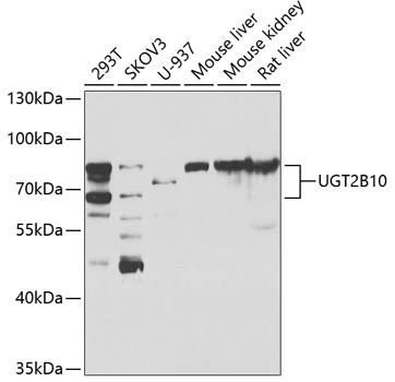 WB analysis of various sample lysates using GTX64878 UGT2B10 antibody. Dilution : 1:1000 Loading : 25microg per lane