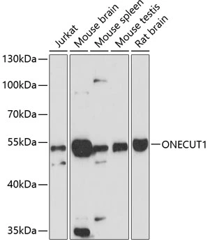 WB analysis of various sample lysates using GTX64885 HNF6 antibody. Dilution : 1:3000 Loading : 25microg per lane