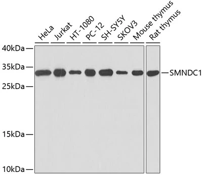 WB analysis of various sample lysates using GTX64887 SMNDC1 antibody. Dilution : 1:1000 Loading : 25microg per lane