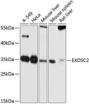 WB analysis of various sample lysates using GTX64892 RRP4 antibody. Dilution : 1:1000 Loading : 25microg per lane WB analysis of various sample lysates using GTX64892 RRP4 antibody. Dilution : 1:1000 Loading : 25microg per lane