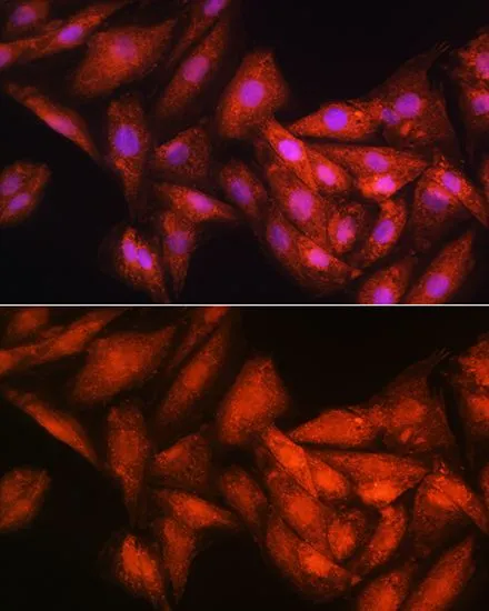 ICC/IF analysis of H9C2 cells using GTX64892 RRP4 antibody. Blue : DAPI Dilution : 1:100