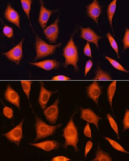 ICC/IF analysis of L929 cells using GTX64892 RRP4 antibody. Blue : DAPI Dilution : 1:100