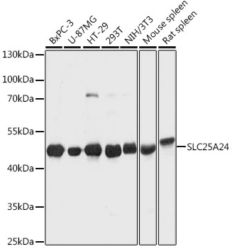 WB analysis of various sample lysates using GTX64897 SLC25A24 antibody. Dilution : 1:1000 Loading : 25microg per lane
