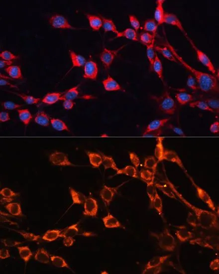 ICC/IF analysis of NIH/3T3 cells using GTX64897 SLC25A24 antibody. Blue : DAPI Dilution : 1:100