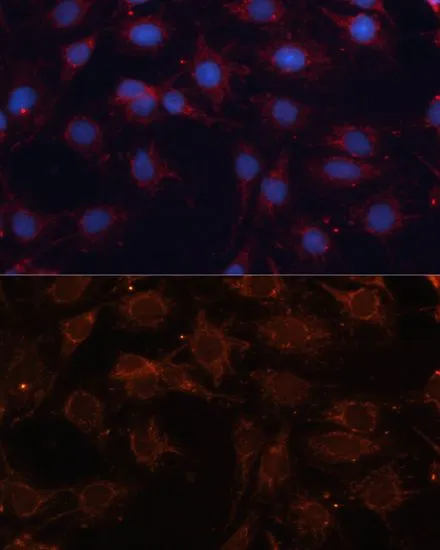 ICC/IF analysis of C6 cells using GTX64897 SLC25A24 antibody. Blue : DAPI Dilution : 1:100