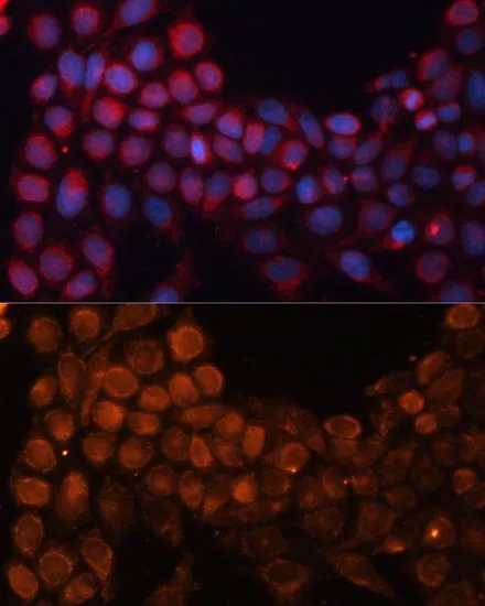 ICC/IF analysis of HeLa cells using GTX64897 SLC25A24 antibody. Blue : DAPI Dilution : 1:100