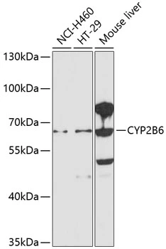 WB analysis of various sample lysates using GTX64899 CYP2B6 antibody. The signal was developed with ECL plus-Enhanced. Dilution : 1:1000 Loading : 25microg per lane