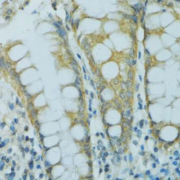 IHC-P analysis of human colon tissue using GTX64899 CYP2B6 antibody. Dilution : 1:100