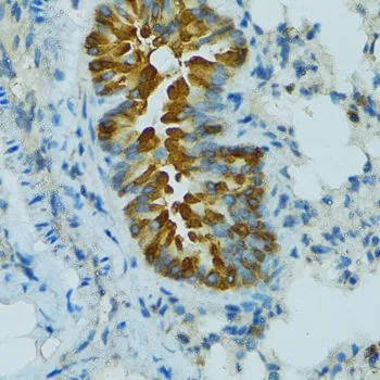 IHC-P analysis of mouse lung tissue using GTX64899 CYP2B6 antibody. Dilution : 1:100