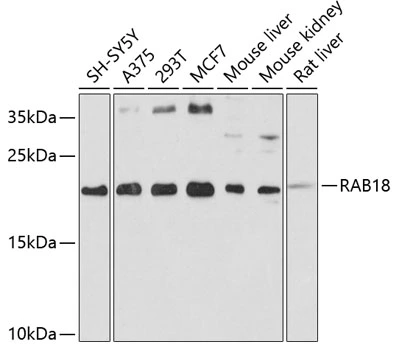 WB analysis of various sample lysates using GTX64901 RAB18 antibody. Dilution : 1:1000 Loading : 25microg per lane WB analysis of various sample lysates using GTX64901 RAB18 antibody. Dilution : 1:1000 Loading : 25microg per lane
