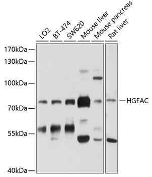 WB analysis of various sample lysates using GTX64906 HGF activator antibody. Dilution : 1:1000 Loading : 25microg per lane WB analysis of various sample lysates using GTX64906 HGF activator antibody. Dilution : 1:1000 Loading : 25microg per lane