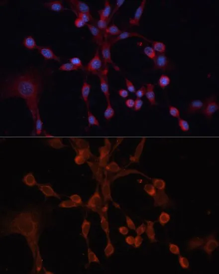 ICC/IF analysis of NIH/3T3 cells using GTX64910 GNA14 antibody. Blue : DAPI Dilution : 1:100