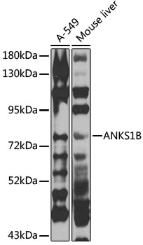WB analysis of various sample lysates using GTX64918 ANKS1B antibody. The signal was developed with ECL plus-Enhanced. Dilution : 1:1000 Loading : 25microg per lane