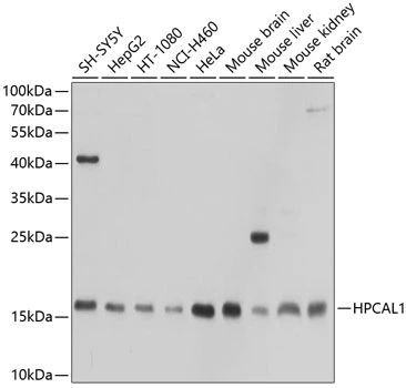 WB analysis of various sample lysates using GTX64929 HPCAL1 antibody. Dilution : 1:1000 Loading : 25microg per lane