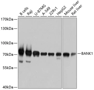 WB analysis of various sample lysates using GTX64930 BANK1 antibody. Dilution : 1:1000 Loading : 25microg per lane WB analysis of various sample lysates using GTX64930 BANK1 antibody. Dilution : 1:1000 Loading : 25microg per lane
