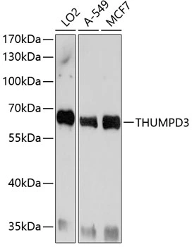 WB analysis of various sample lysates using GTX64933 THUMPD3 antibody. Dilution : 1:1000 Loading : 25microg per lane WB analysis of various sample lysates using GTX64933 THUMPD3 antibody. Dilution : 1:1000 Loading : 25microg per lane
