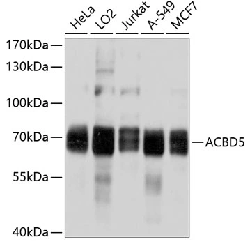 WB analysis of various sample lysates using GTX64935 ACBD5 antibody. Dilution : 1:1000 Loading : 25microg per lane WB analysis of various sample lysates using GTX64935 ACBD5 antibody. Dilution : 1:1000 Loading : 25microg per lane