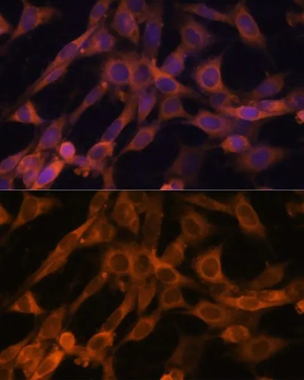 ICC/IF analysis of NIH/3T3 cells using GTX64938 RAB21 antibody. Blue : DAPI Dilution : 1:100