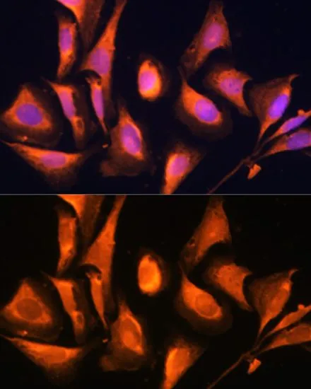 ICC/IF analysis of U2OS cells using GTX64938 RAB21 antibody. Blue : DAPI Dilution : 1:100