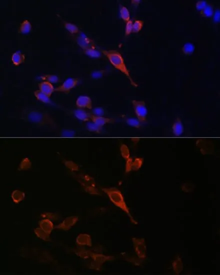 ICC/IF analysis of U2OS cells using GTX64938 RAB21 antibody. Blue : DAPI Dilution : 1:100
