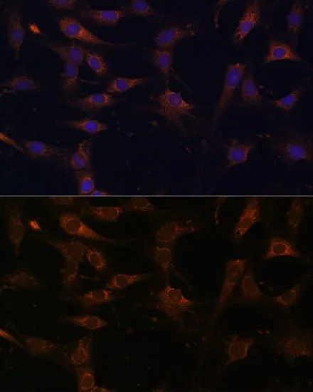 ICC/IF analysis of C6 cells using GTX64938 RAB21 antibody. Blue : DAPI Dilution : 1:100