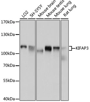 WB analysis of various sample lysates using GTX64954 KAP3 antibody. Dilution : 1:1000 Loading : 25microg per lane