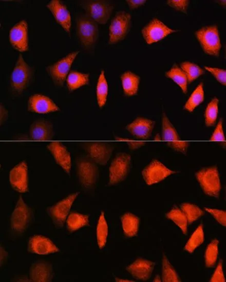 ICC/IF analysis of L929 cells using GTX64954 KAP3 antibody. Blue : DAPI Dilution : 1:100