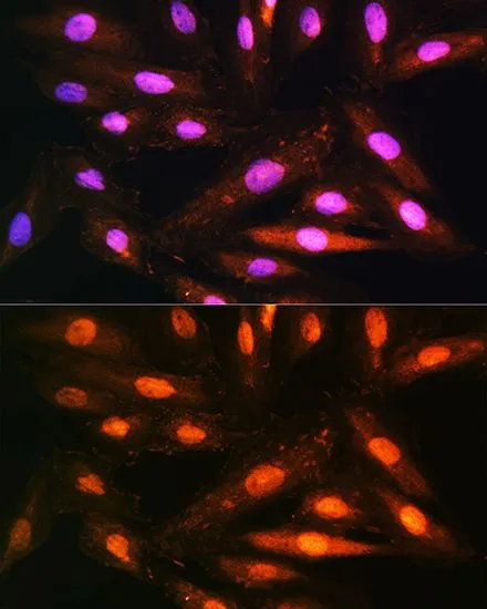 ICC/IF analysis of H9C2 cells using GTX64954 KAP3 antibody. Blue : DAPI Dilution : 1:100