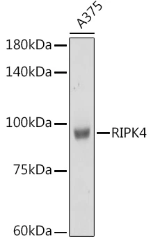 WB analysis of A375 cell lysate using GTX64956 RIPK4 antibody. Dilution : 1:1000 Loading : 25microg per lane WB analysis of A375 cell lysate using GTX64956 RIPK4 antibody. Dilution : 1:1000 Loading : 25microg per lane