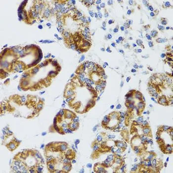 IHC-P analysis of human stomach tissue using GTX64956 RIPK4 antibody. Dilution : 1:100