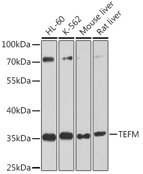 WB analysis of various sample lysates using GTX64957 TEFM antibody. Dilution : 1:1000 Loading : 25microg per lane WB analysis of various sample lysates using GTX64957 TEFM antibody. Dilution : 1:1000 Loading : 25microg per lane