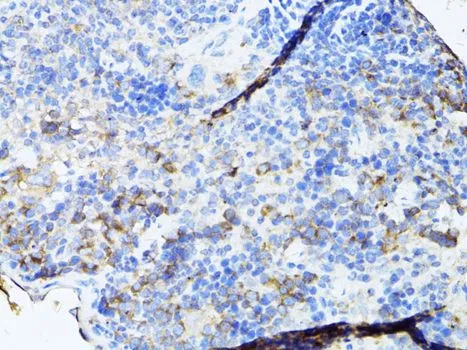 IHC-P analysis of mouse spleen tissue using GTX64957 TEFM antibody. Dilution : 1:100