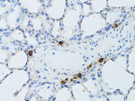 IHC-P analysis of rat lung tissue using GTX64957 TEFM antibody. Dilution : 1:100