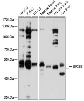 WB analysis of various sample lysates using GTX64963 eIF2B3 antibody. Dilution : 1:1000 Loading : 25microg per lane WB analysis of various sample lysates using GTX64963 eIF2B3 antibody. Dilution : 1:1000 Loading : 25microg per lane